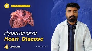 Hypertensive Heart Disease  Medical Pathology  Textbook Online Lectures  VLearning [upl. by Aicirtal355]