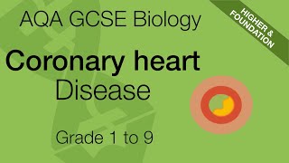 AQA GCSE Biology Coronary Heart Disease Explained  GCSE 91 Revision [upl. by Auburn]