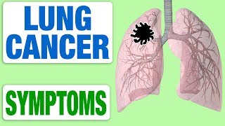 Lung Cancer  All Symptoms [upl. by Delanie]