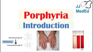 Introduction to Porphyria  Porphyria Cutanea Tarda vs Acute Intermittent Porphyria [upl. by Eadahc]