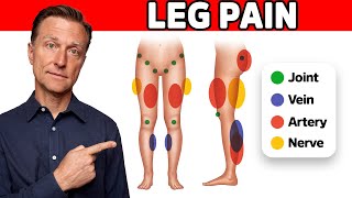 Common Causes of Leg Pain and Treatments [upl. by Anis]