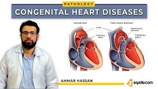 Congenital Heart Diseases  Introduction and Classification  Pathology Lectures  VLearning™ [upl. by Ricard527]