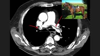 High Yield CT Scans Part 1  USMLE [upl. by Aggappora499]