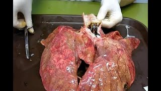 Video muestra el efecto de 60 cigarros en los pulmones [upl. by Adeline]