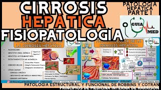 CIRROSIS HEPÁTICA FISIOPATOLOGÍA  GuiaMed [upl. by Harrow]