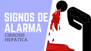 Signos de alarma en Cirrosis Hepática [upl. by Notelrahc382]