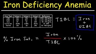 Iron Deficiency Anemia  TIBC UIBC Iron Saturation Transferrin amp Ferritin [upl. by Terrence]