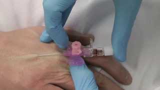 Cannulation How to gain IV access [upl. by Ahcurb]