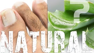 Are Natural Remedies to Treat Nail Fungus Effective [upl. by Groos998]