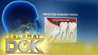 Salamat Dok Expert talks about wisdom tooth [upl. by Rausch385]