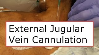 External Jugular Vein Cannulation [upl. by Isewk]