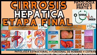 CIRROSIS HEPÁTICA ETAPA FINAL  GuiaMed [upl. by Alenoel]