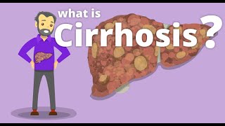 Cirrhosis  What is cirrhosis [upl. by Samantha]