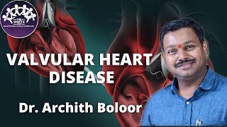 VALVULAR HEART DISEASE [upl. by Vaas]