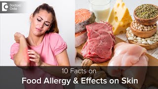 Food Allergy amp how it affects SKIN  Causes Symptoms amp TreatmentDrRajdeep Mysore Doctors Circle [upl. by Gentille]