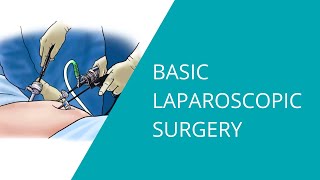 Basic Laparoscopic Surgery [upl. by Oilasor]