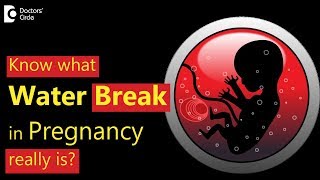 What is water break in pregnancy  Dr Usha B R [upl. by Esertak996]