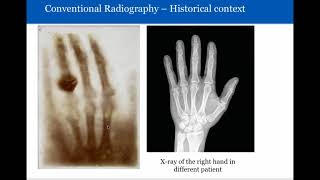 Introduction to Radiology Conventional Radiography [upl. by Otaner]