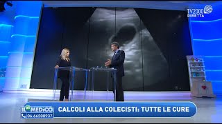 Calcoli alla colecisti ecco cosa fare [upl. by Lyell]