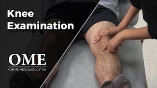 Knee Examination  Orthopaedics [upl. by Kippy]