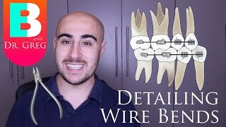 BRACES EXPLAINED Detailing Wire Bends [upl. by Yi]