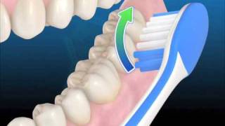Técnica de higiene con cepillo manual [upl. by Nyleak562]